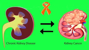 kidney disease and future cancer risk