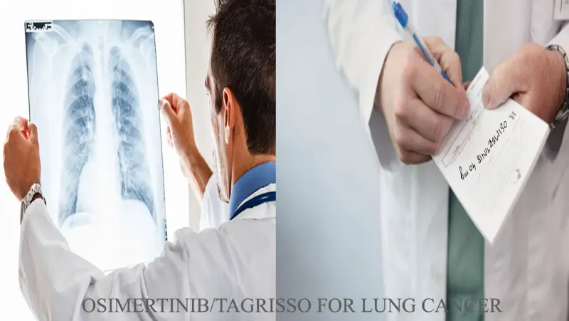 How Tagrisso Osimertinib medication can treat your lung cancer