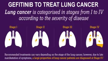 The role of Gefitinib in treating Non small cell lung cancer and mutated Lung Cancer