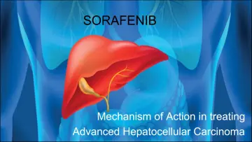 Sorafenib Mechanism of Action in treating Advanced Hepatocellular Carcinoma