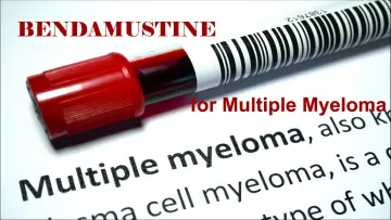 Bendamustine treatment for Multiple Myeloma