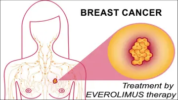 Breast cancer treatment by Everolimus Therapy