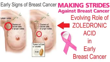 Evolving role of zoledronic acid in early breast cancer