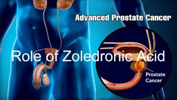 Role of Zoledronic acid in treating Prostate Cancer