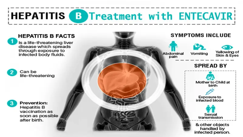 Hepatitis B treatment with Entecavir