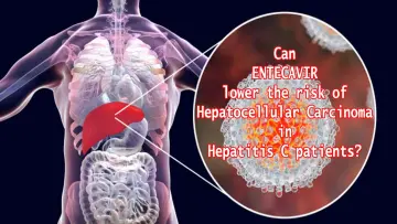 Can Entecavir lower the risk of Hepatocellular carcinoma in Hepatitis C patients
