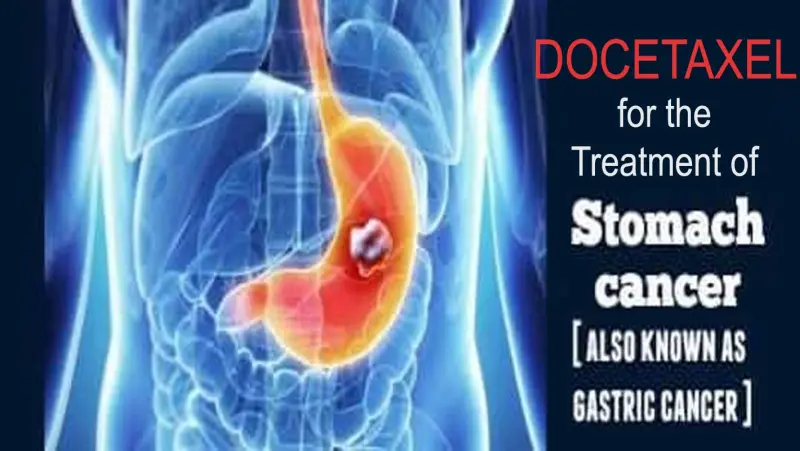 Gastric Cancer Treatment with Docetaxel