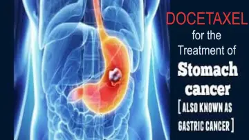 Gastric Cancer Treatment with Docetaxel