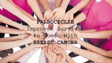 Palbociclib Improves Survival in Women with Breast Cancer