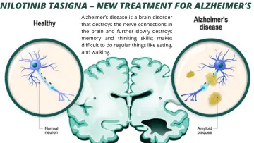 Nilotinib Tasigna new Treatment For Alzheimers