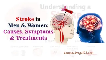 Stroke in men women causes symptoms treatments