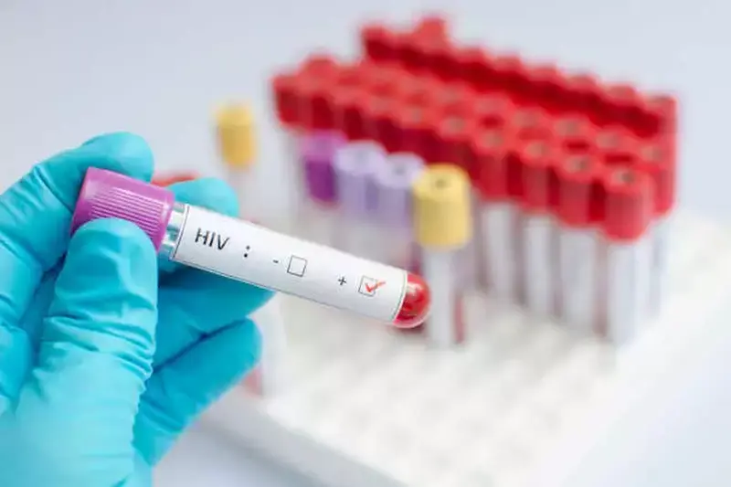 A Guide to Managing HIV AIDS Medication Costs