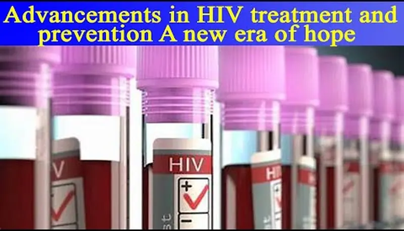 Patients Reference to Latest HIV AIDS Medications